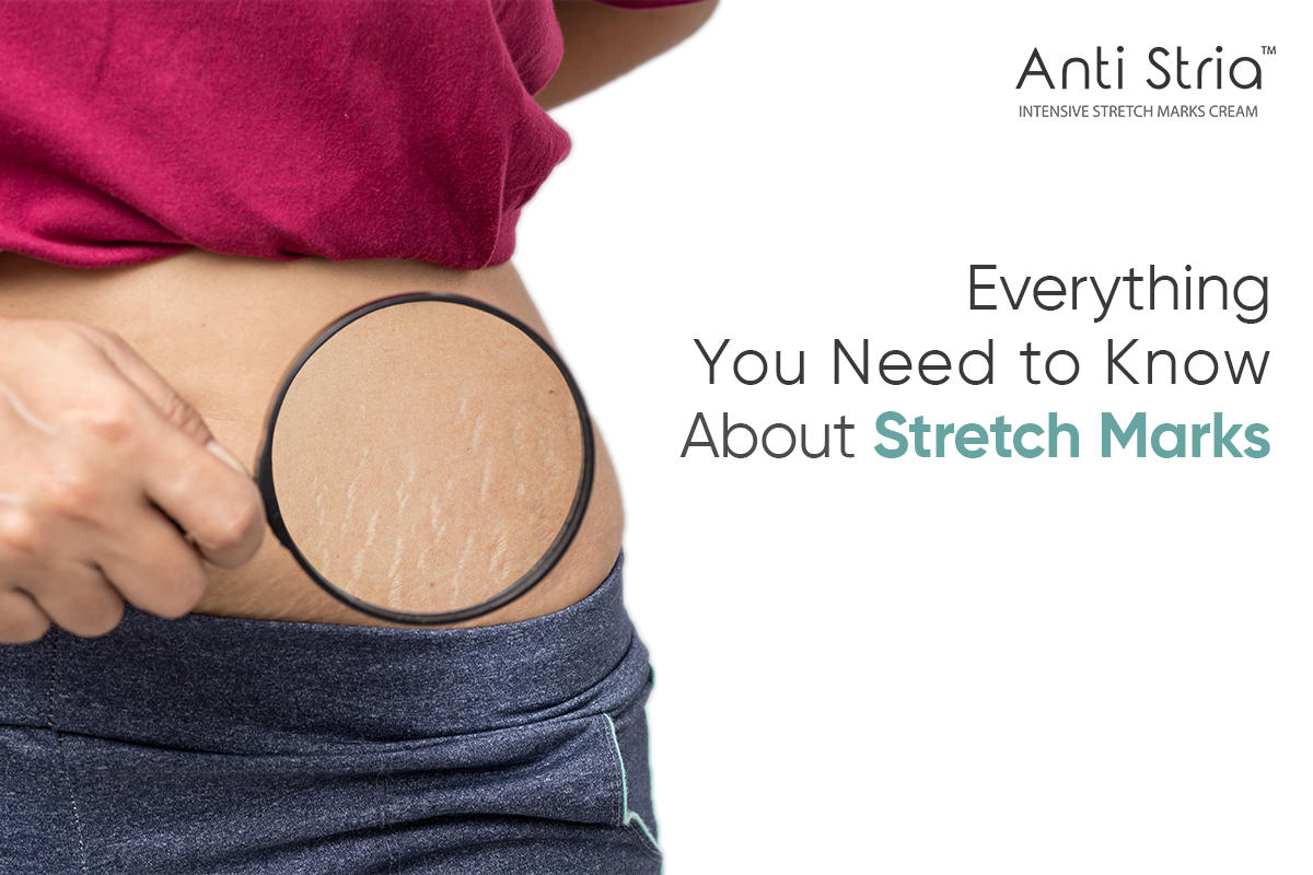 Best Stretch Marks Creams